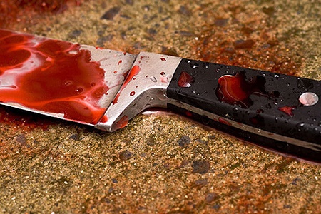В Домодедово женщина порезала мужчину ножом