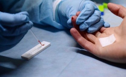 ​ Более 6 тысяч жителей Домодедова прошли тестирование на наличие ВИЧ-инфекции с начала года