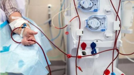 В Домодедовской больнице появился аппарат искусственной почки